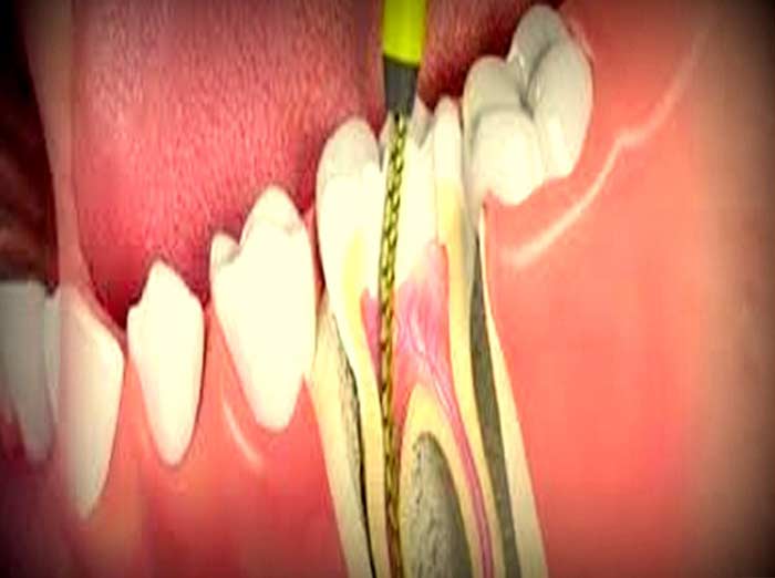 dental