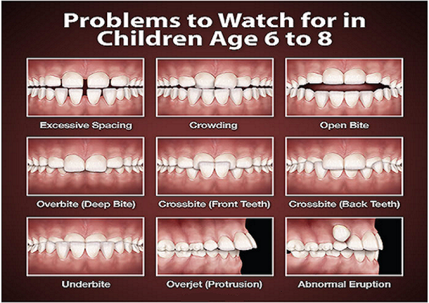 dental