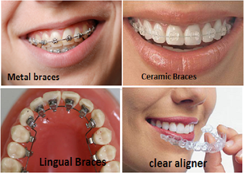 dental