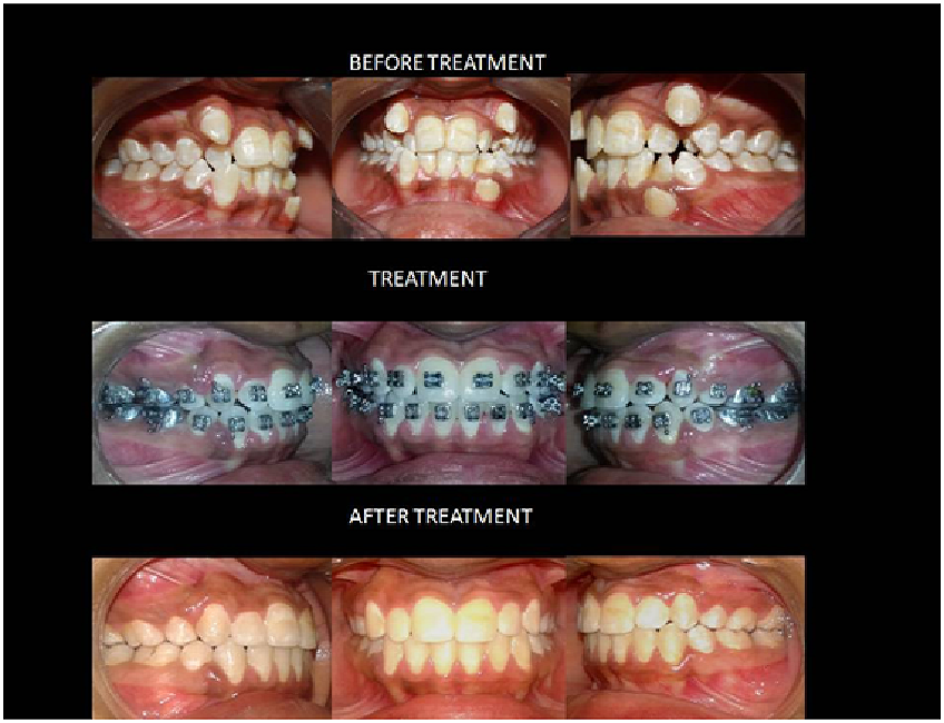 dental