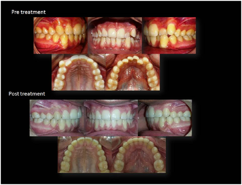 dental